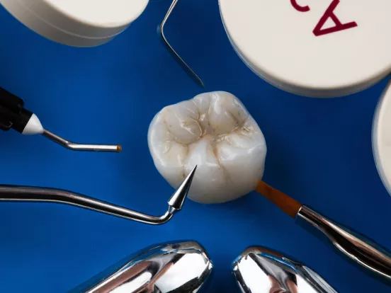 Dental Crown Cementation